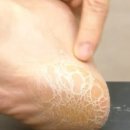 딱풀통신 이미지