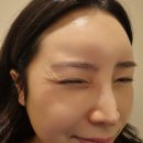 다산더올림의원 | [남양주 피부과]다산 유앤아이의원 스킨보톡스&amp;사각턱 보톡스 내돈내산(스킨보톡스통증)