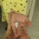 세라테라피 이미지