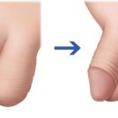 라파엘외과의원 네이버블로그