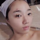 영대병원네거리(송한의원 앞) | 대구 남구 아르떼 : 내돈주고 받고온 아쿠아필 후기 / 여드름 피부관리실 추천