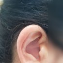 뉴이어보청기(대구센터) | 대구수성구보청기 센터 청력검사 잘 해주세요