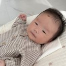 [닥터지니 성형외과] 7개월 아기 멜라닌모반 수술 후기