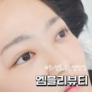 [엠블리뷰티] 불편함 없이 예뻐진 노글루수분펌후기