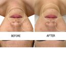 마인힐에스테틱 이미지