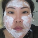 연일제일가정의원 | 내돈내산_ 청량리 편평사마귀 제거 예약성공 후기