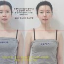 강남 예신관리 비대칭관리 [클리니스킨 강남본점]