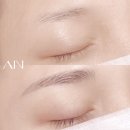 아인뷰티의원 이미지