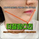 라인마트 | 송도피부관리 더끌림스킨 하이푸 리프팅 후기: 20년 내공으로 빚은 V라인의 기적!