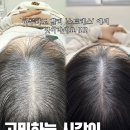 아이콘스칼프