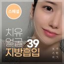 치유성형외과의원 이미지