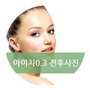 아미치0.3 - 서구 | 아미치0.3