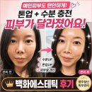 백화에스테틱 네이버블로그