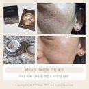 메디시드 기미잡티 크림 후기 50대 피부 나이 충격받고 시작한 관리