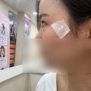 언주역 온 김에 레이저로 점 (기미) ? 빼러 아미스킨의원 강남점 방문