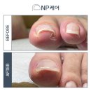 엔피케어 - 중구 종가6길 4-5 | 엔피케어