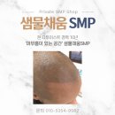 현헤어라인 이미지