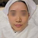 교대역 2번출구 | 교대역 리프팅 관리 레비나스 후기(고통, 효과, 다운타임)