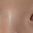 더레드피부과의원 이미지