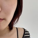 [불당동] 피부과 슈링크 500샷 후기 피코토닝 아이슈링크 포함