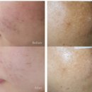 화이트피부관리실 이미지