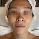 살롱드세이렌 구로 에스테틱 신부관리 피부관리 추천 플라즈마 관리 후기