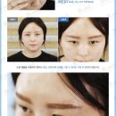 에이스메디코스 네이버블로그