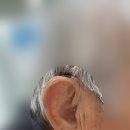 사상독일보청기 이미지