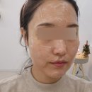포항 대도동 고주파 피부 관리(프리미엄프로그램) 전문샵 &#39;온유스킨&#39; 방문 후기