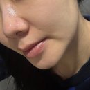 자유공간2호_파장동 | 강남역피부관리 에스테틱공간 2호점 모공 스케일링 후기｜피지·블랙헤드 정리 받은 솔직관리