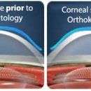 드림안경콘택트 이미지