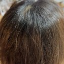 뉴샴푸 | TS 뉴프리미엄 탈모샴푸 내돈내산 후기