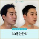 고운피부힐링케어