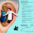 소리안보청기 이미지