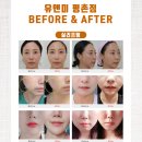 유앤미피부과의원 | 토닝 기미 잡티 색소침착으로 고민이신 분? 환하고 잡티 없는 깨끗한 피부관리 레이저 잘하는 평촌역피부과