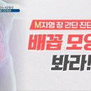 케렌시아 솔 이미지