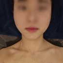 광교 에스테틱 달리아스파 1회 받고 내돈내산 10회 끊은 후기