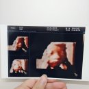[새싹일기/28w 2d] 광명GM제일산부인과 말기초음파, 입체초음파