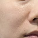 경희네팥죽 | 모공축소 로니실린 내돈내산 보름후기