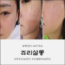 쥬리살롱 | 💖 [진월동피부관리] 쥬리살롱 멜라올킬 후기! 광주피부관리 받고 잡티 고민 끝!