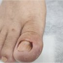 파나슈 뷰티 | 내 발톱 건강, 인천무좀발톱관리 제대로 하는 곳 찾고 있다면 파나슈뷰티의 힐링 서비스 소개