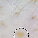 경기정화(자) - 1429 | 치료 후 머리카락이 안 자라는 이유? 모공 속 '약물 찌꺼기' 녹여내는 두피 정화 라인 4회 실제 관리 후기