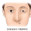 머리 아플 때 원인 대처법 이미지