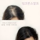 잉크본 이미지