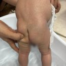 백병원(중) | 신생아 딤플 초음파 2차 병원 상계백병원 후기 : 1차 영유아 검진 후 검사 진행(비용, 과정, 준비사항)