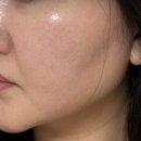 11650-1-10-700 | 리들샷700 vt 사용방법 후기ㅣ한달 후기 ft. 민감피부