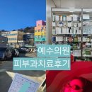 피부사랑피부과의원 | 대구예수의원/피부치료/피부과치료후기/알레르기치료