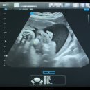 둥지세탁 | 임신 34-36주차 증상, 가진통, 세브란스 막달검사, 아기손수건 아기옷세탁, 맘마존 준비, 임산부 일상