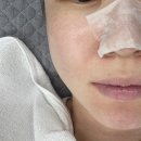눈소1길 | 울산피부관리 홍조 피부 열감 내리기 위크원 후기