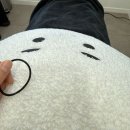 광일약국 | 청담동피부과 쥬베룩볼륨 2회차 찐후기